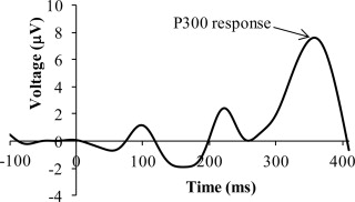 urst of activity occurs 300 ms after the presented incentive